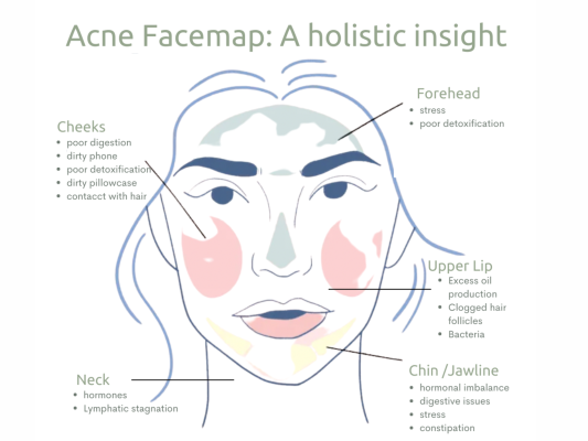 Why Is My Skin Breaking Out: 10 Causes of Acne | AjantaStore
