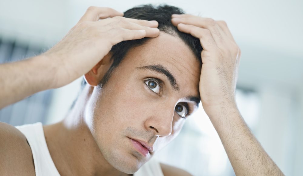 male pattern baldness