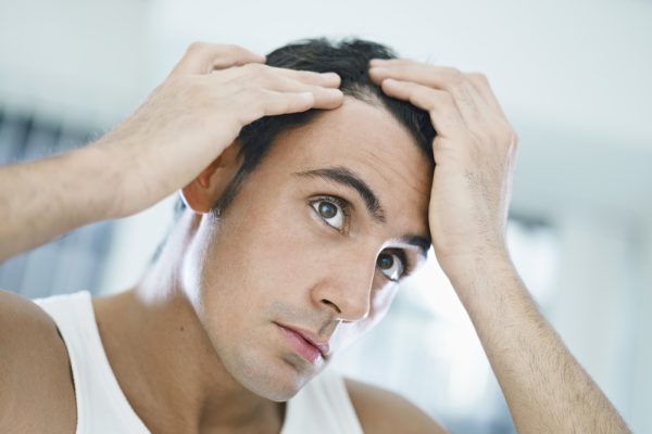 male pattern baldness