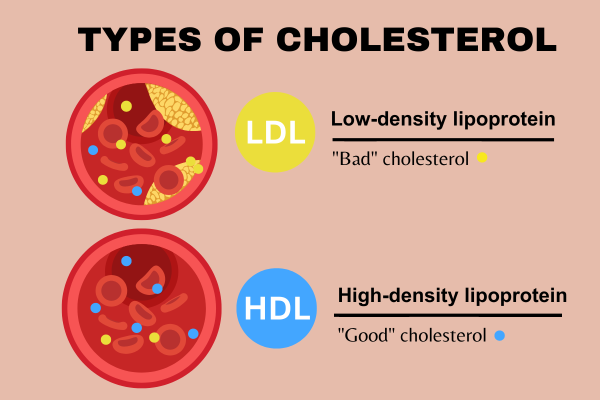 Best Drugs for High Cholesterol | AjantaStore Expert Blog