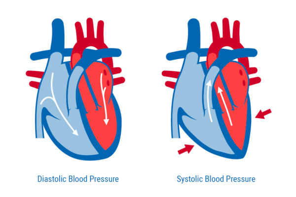 Blood Pressure Hypertension Signs and Symptoms | AjantaStore