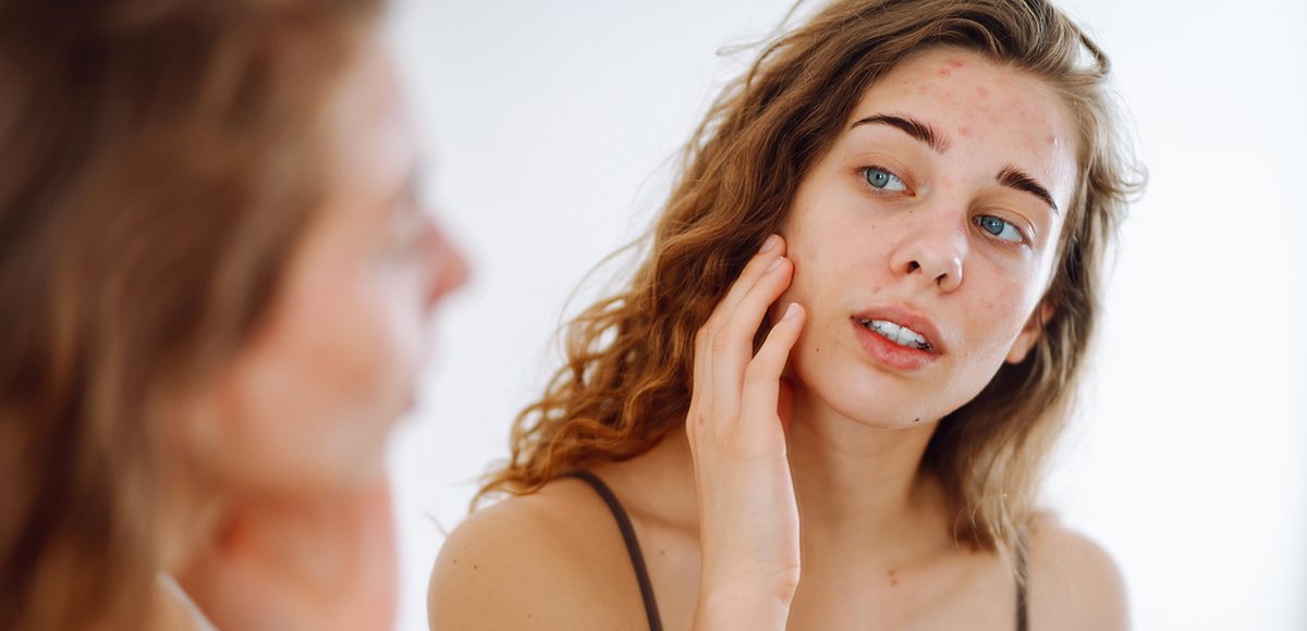 why am I breaking out